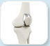 biomet